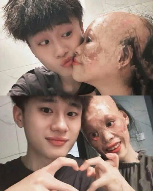 Từ bé tôi đã nổi tiếng xinh nhất vùng, nhưng một s/ự c/ố đã khiến dung nhan của tôi không còn nữa